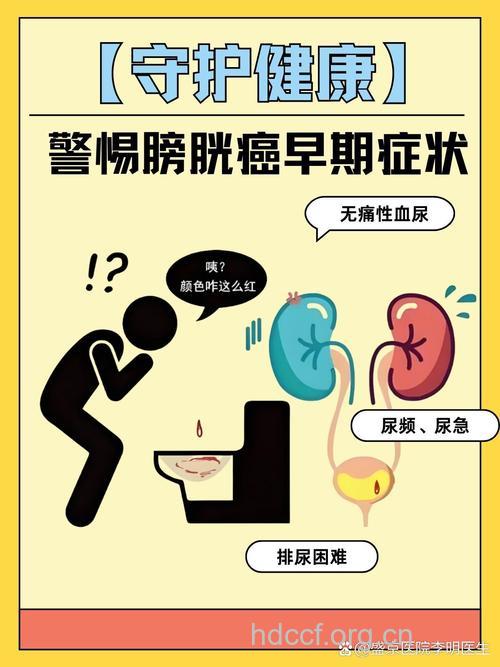 常接触染料膀胱癌发病高