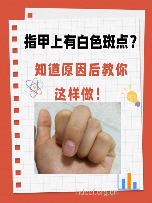 指甲上有白点是什么问题呢?