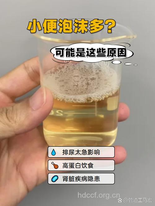 老人小便泡沫多要查什么