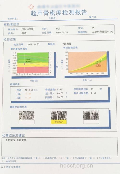 老人看骨密度检查结果