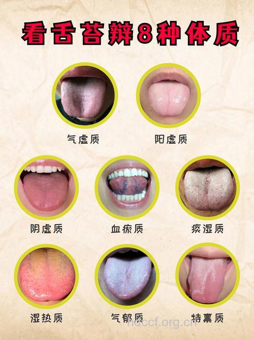 中医教你全面看舌苔辨体质