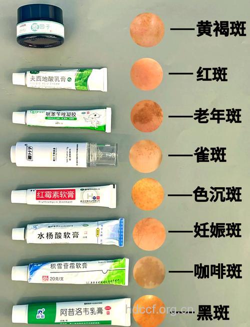 淡化色斑用药有哪些注意
