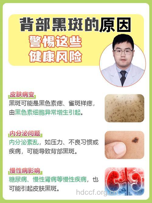 隐藏在老年斑后面健康问题