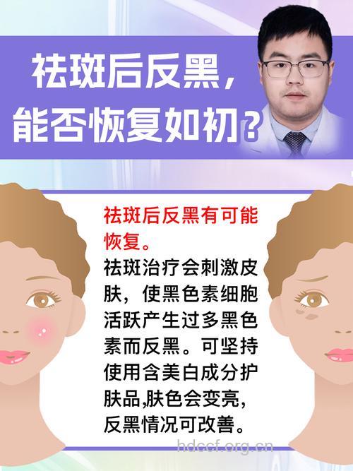 纳米波复合治疗黄褐斑的优势