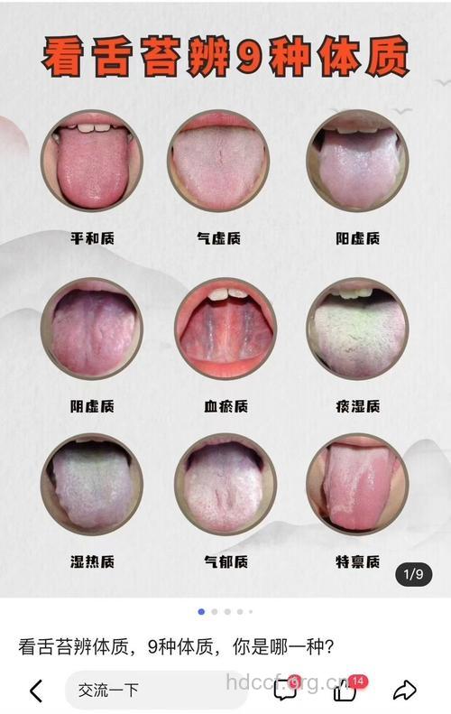 中医望闻问切之看舌苔