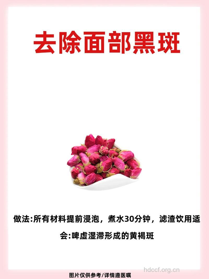 黑斑的治疗方法