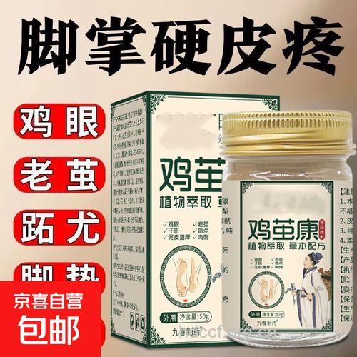 治疗脚鸡眼的中药偏方有哪些?