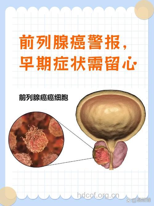 老年人如何排查早期前列腺癌?