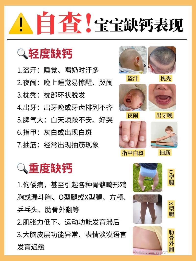 这样做可检查宝宝是否缺钙