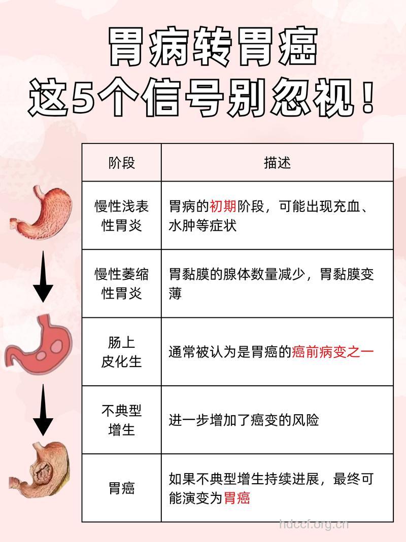 五种信号预示胃癌发生