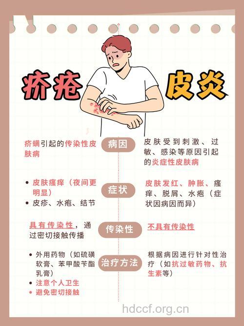 疥疮的诊断和预防