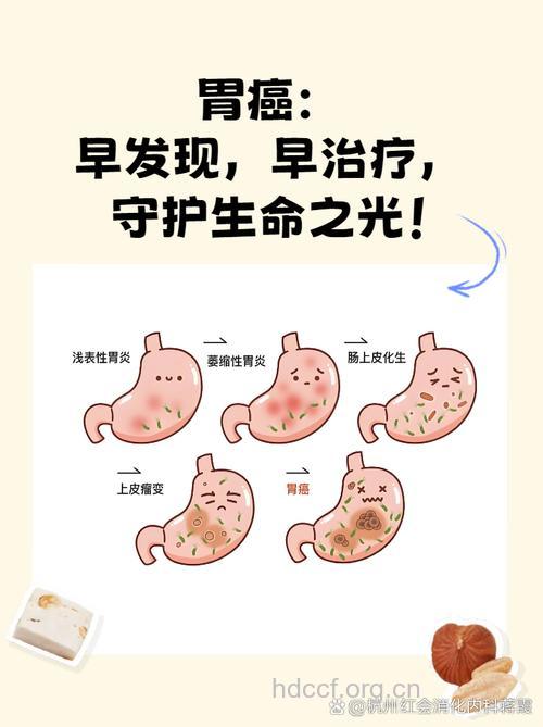 胃癌的病源主要有哪些