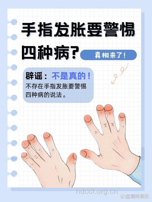 手上总长胖怎么办？该如何治疗