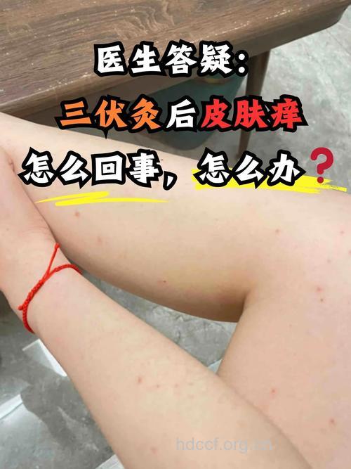 三伏天 治疗皮肤病的好时节