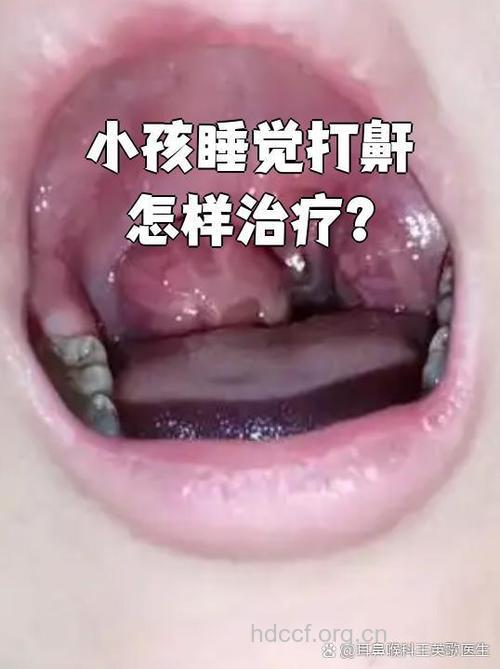 宝宝入睡打鼻鼾要做什么检查