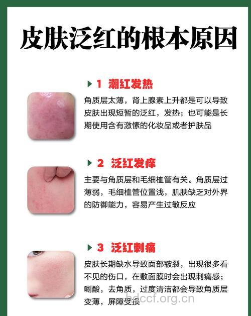 初春皮肤又红又痒怎么办