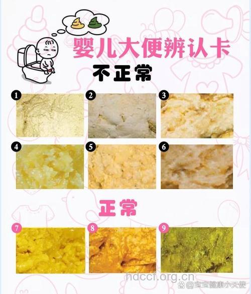 怎么判断宝宝大便是否正常