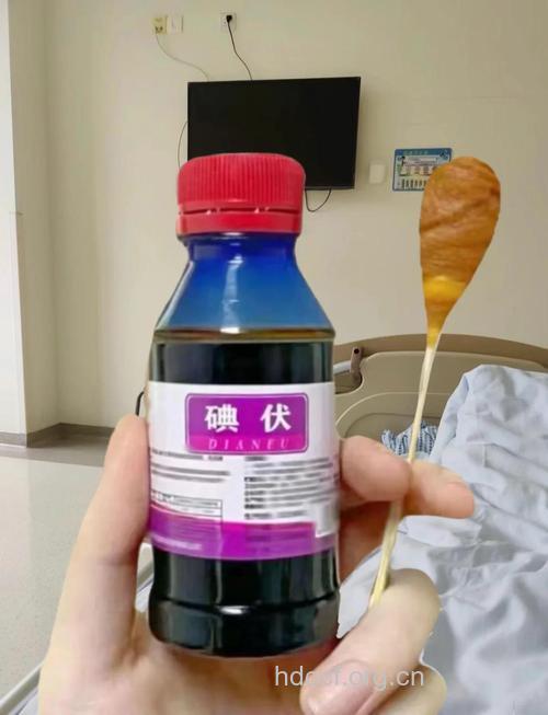 碘酒治皮肤病有奇效