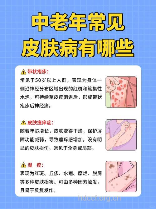 老人夏季应该预防这些皮肤病