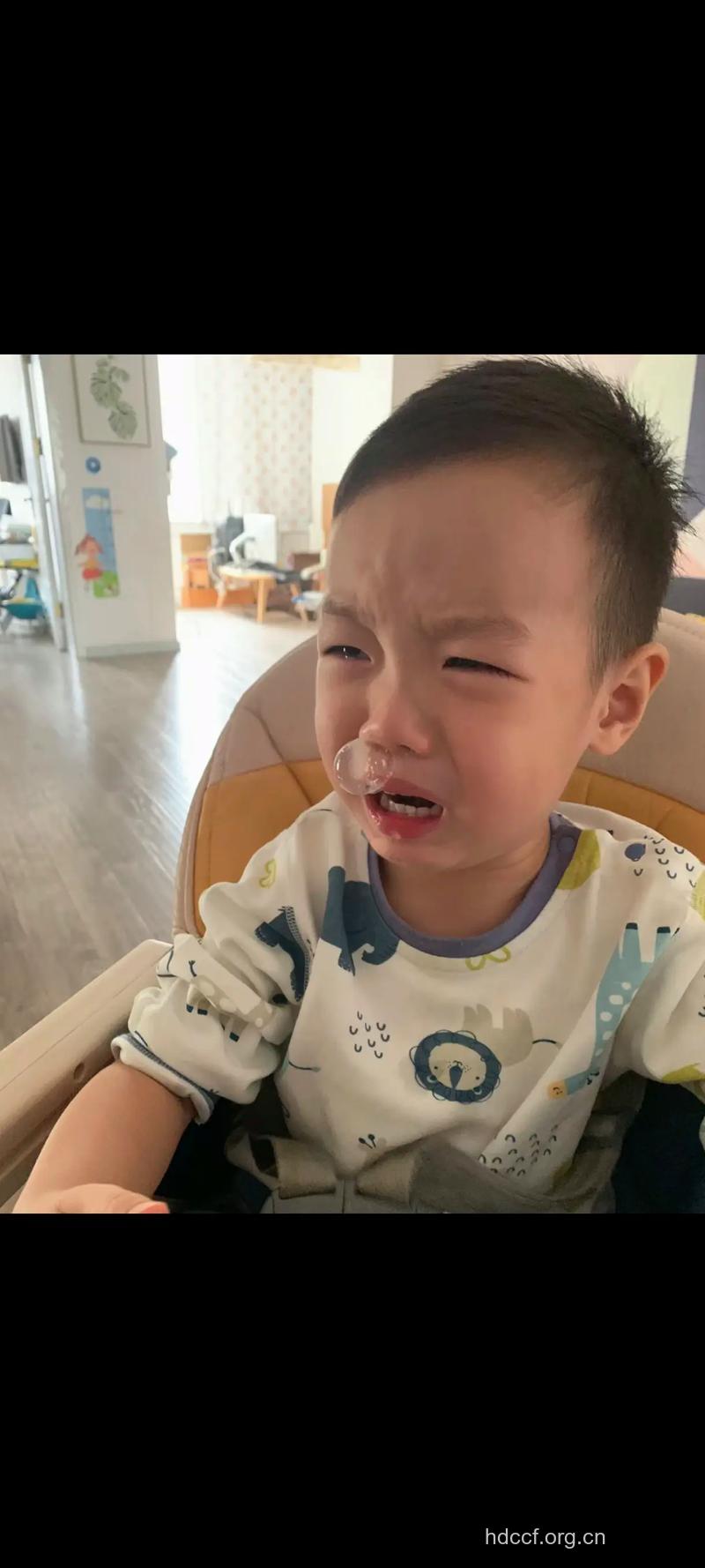 小孩流鼻涕不容忽视