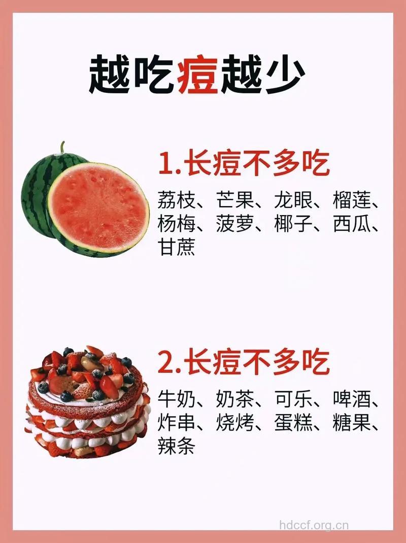 青春痘患者哪些食物不能吃