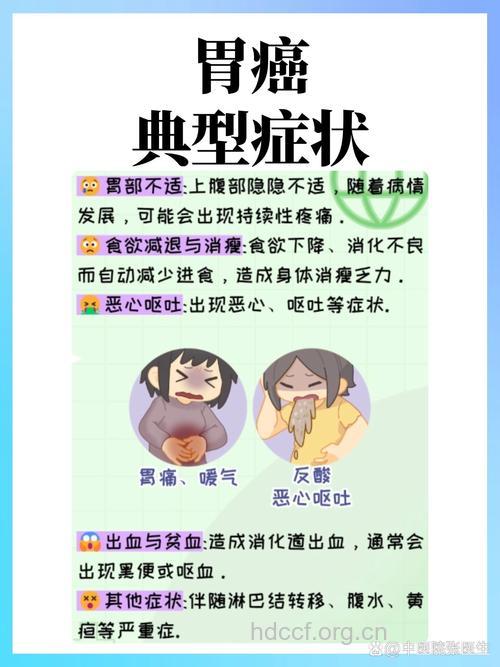 女性胃癌的早期症状是哪些