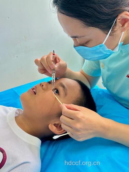 儿童眼部检查将眼病扼杀在萌芽