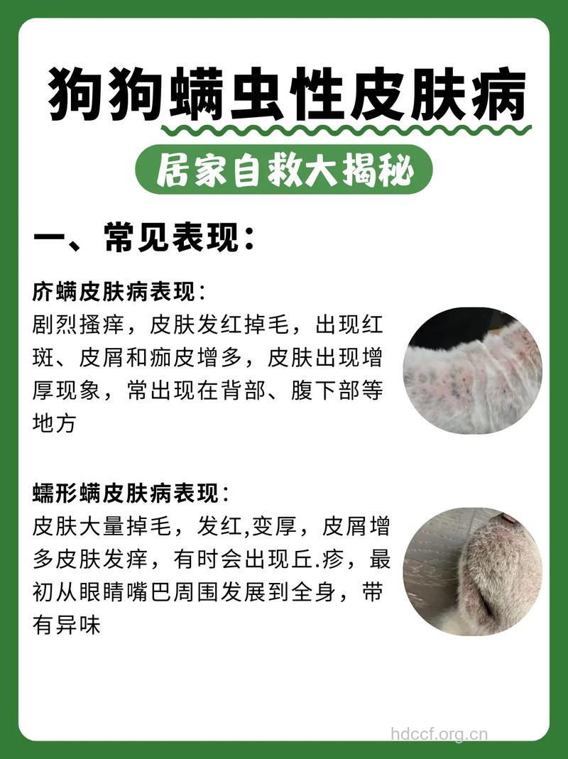 疾病百科 螨虫性皮炎是什么呢