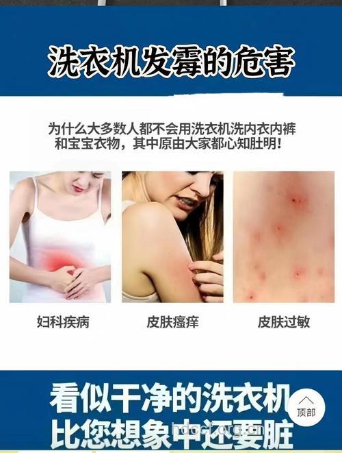 洗衣机久用不洗或引发皮肤病