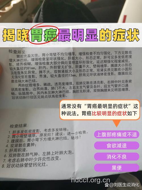 晚期胃癌的明显症状