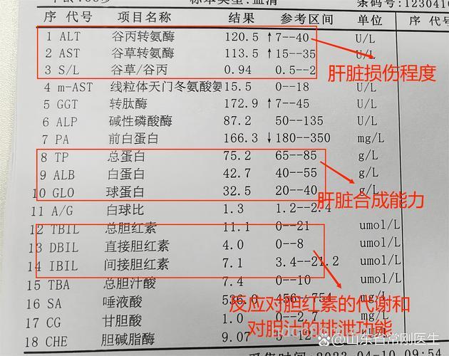 肝功能检查体检表怎么看