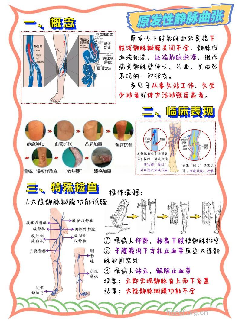 下肢静脉曲张的检查意义