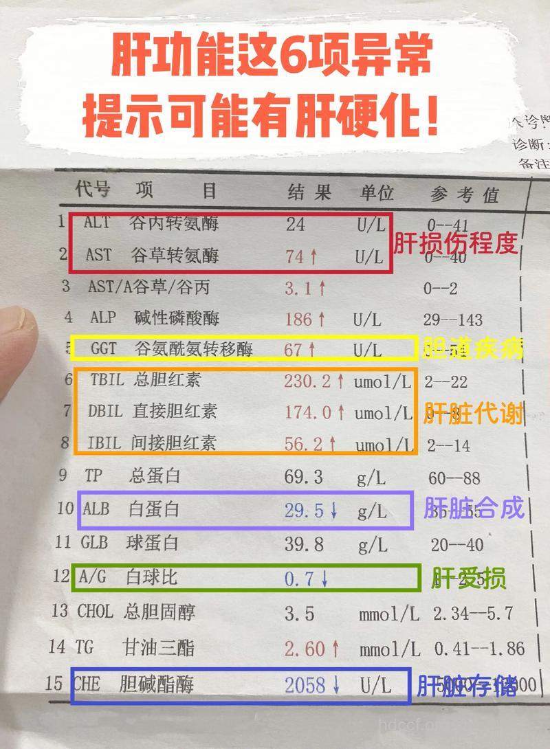 谷草转氨酶偏高警惕肝功能异常