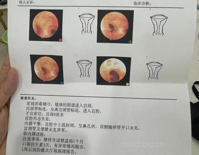 子宫内膜病理检查怎么看