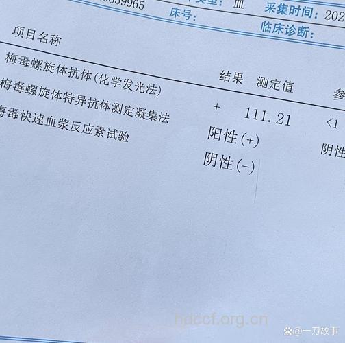 梅毒体检化验要看仔细