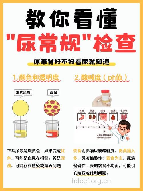 看懂尿常规检查 了解肾脏健康