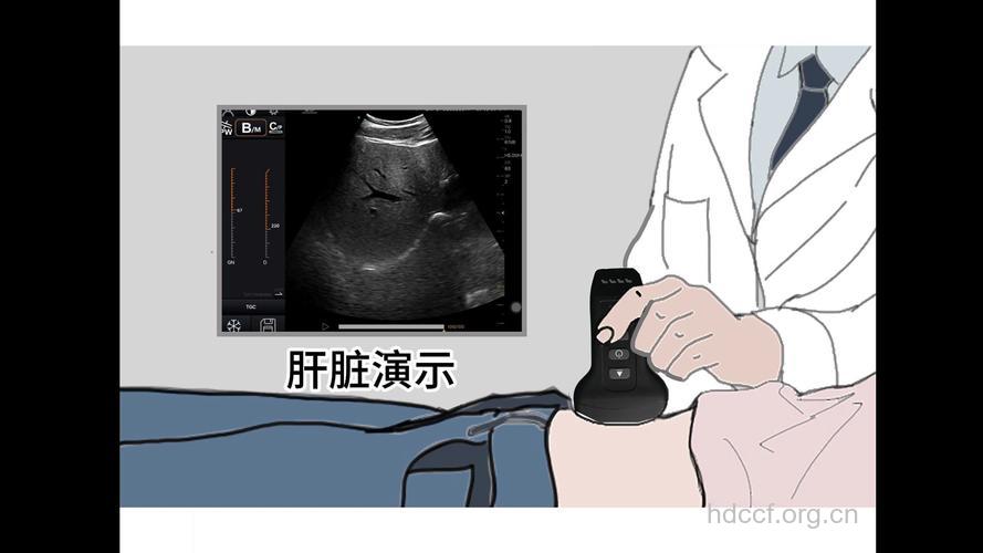 肝脏怎么进行多普勒检查