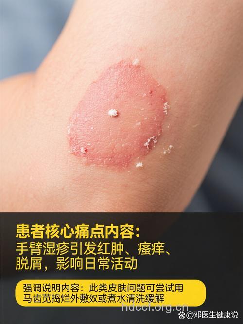 水马齿苋的功效与作用