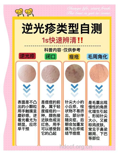 自我诊断皮肤病的方法