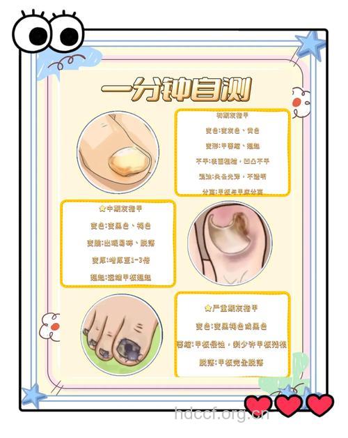 推荐保养指甲的健康食谱