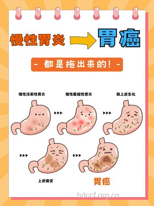 有慢性胃炎会不会得胃癌