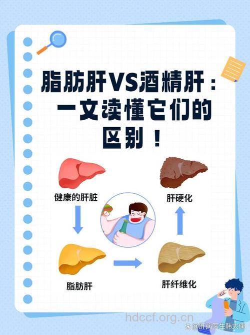 两个地方区别酒精肝与脂肪肝