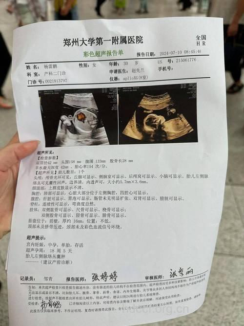 如何看懂孕期检查报告？