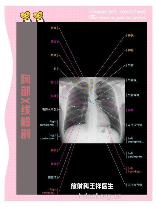 怎么正确看胸片详解?