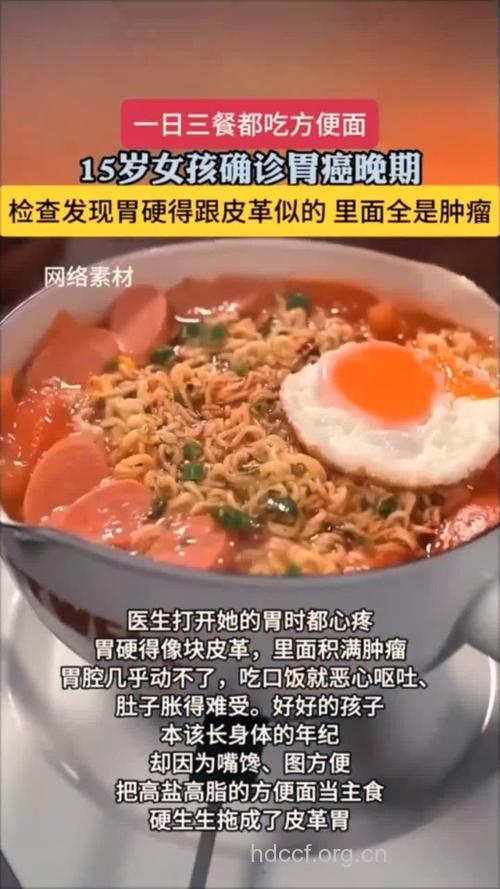 长期食用方便面可引发胃癌