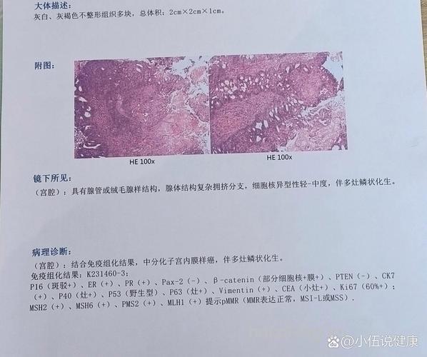 子宫内膜病理检查结果分析的意义