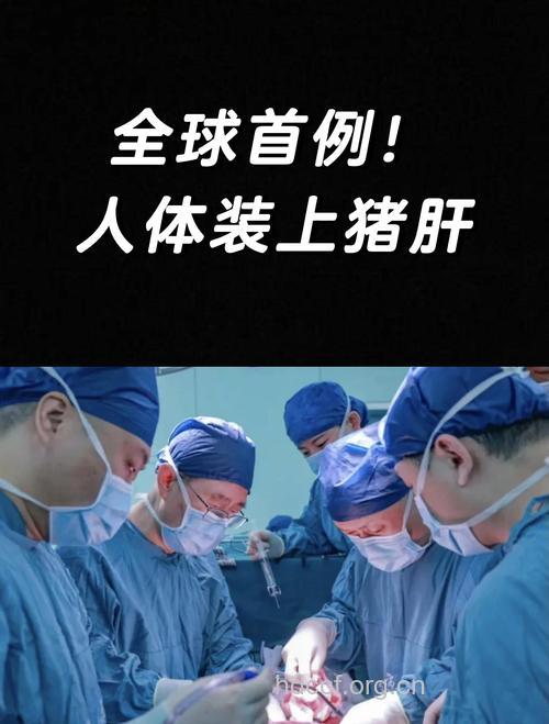 哪些人应该做肝脏移植