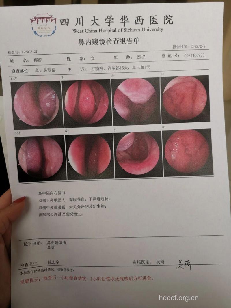 什么是鼻咽部活组织检查?