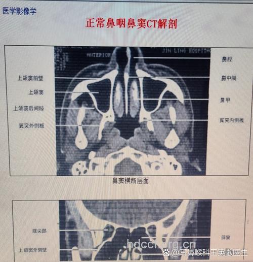 鼻甲和鼻道的检查是怎样的？