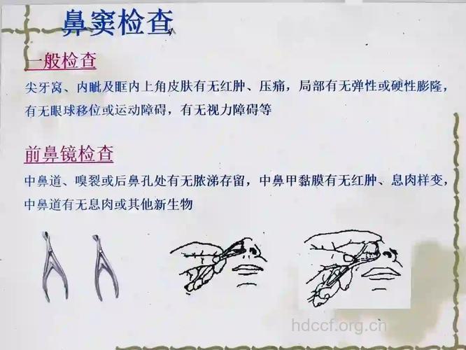 鼻窦检查是怎样的物理检验？